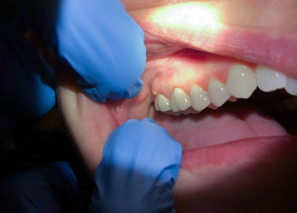 Best 24-Hour Emergency Dental Care in Liberty, TX